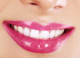 Бижутерия для зубов? Почему бы и нет!