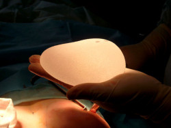Маммопластика – операция на груди
