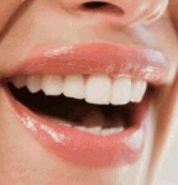 Как самостоятельно отбелить зубы, не повредив при этом эмаль?